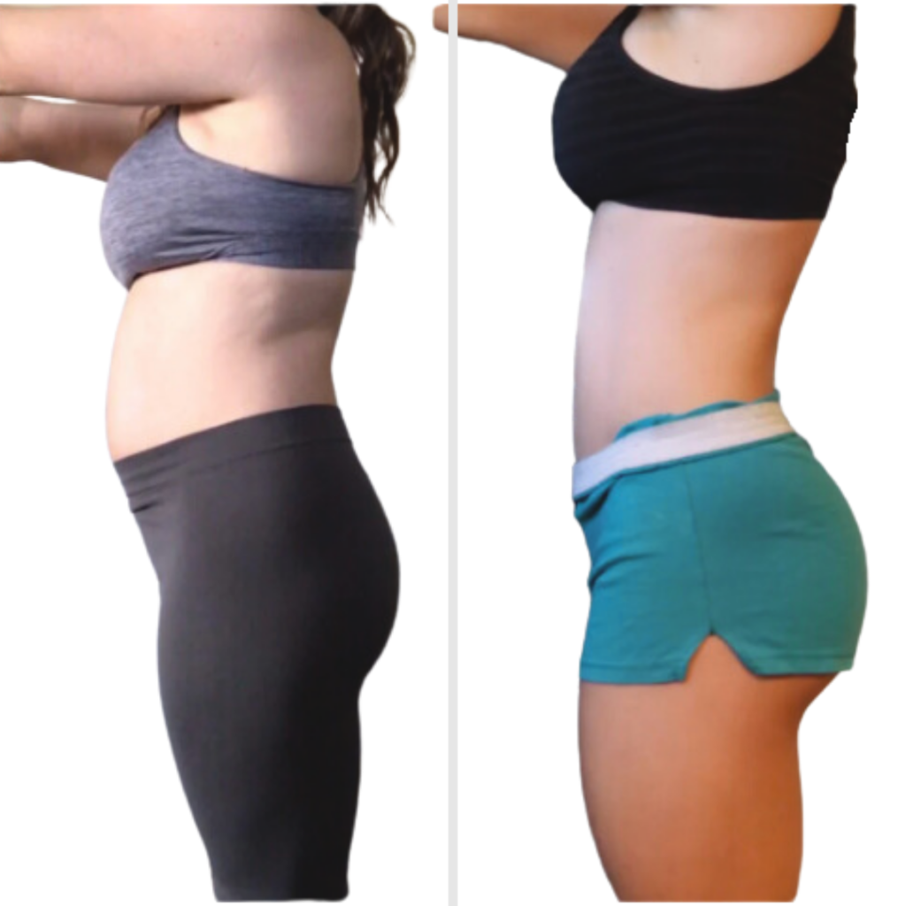 CARRE Avant Après (1)